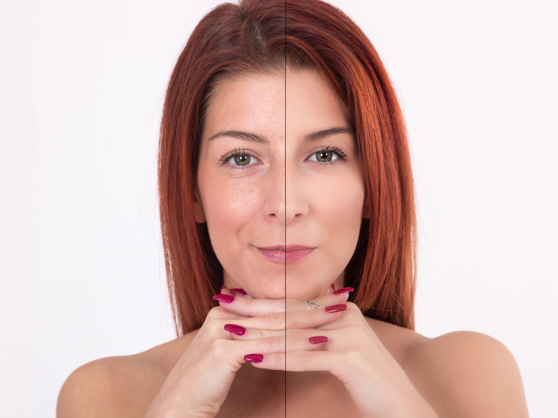 beauté peau