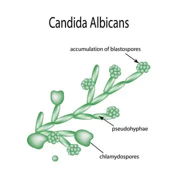 candidose digestive candida albicans