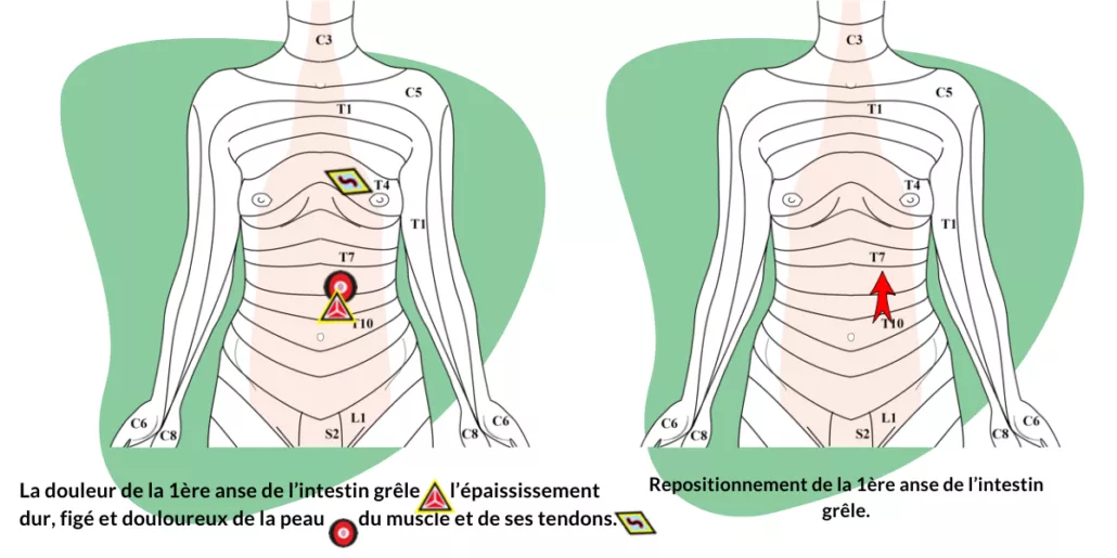 massage spécifique candidose digestive novalturel