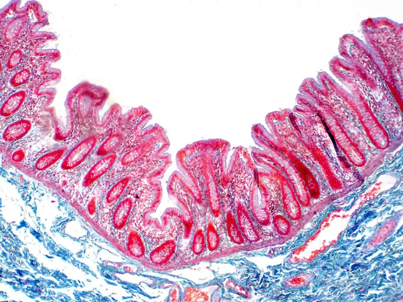 perméabilité-intestinale-hyperpermeabilite-novaltera-traitement-naturel-porosité-intestinale perméabilité-intestinale-hyperpermeabilite-novaltera-traitement-naturel-porosité-intestinale