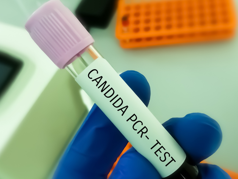 test pcr candida test pcr candida