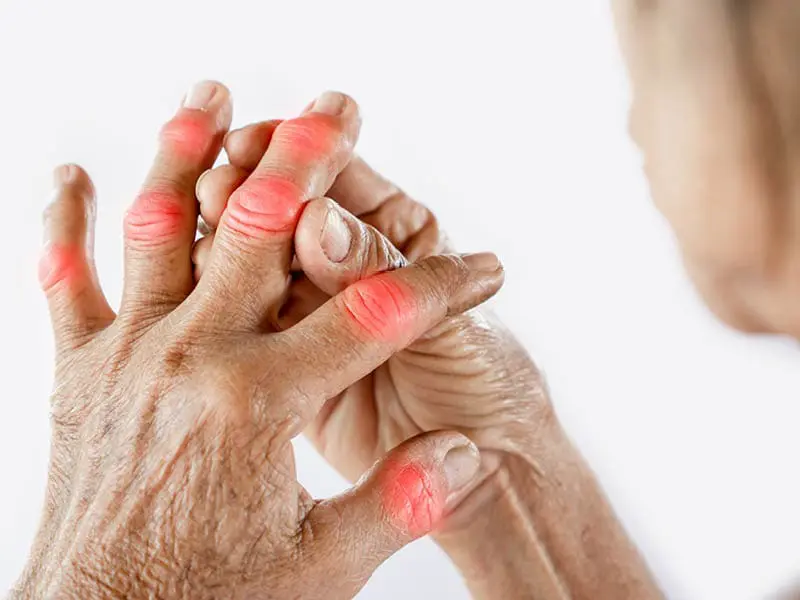 arthrite arthrose douleur articulaires articulations mobilité articulaire novalflex novalfen