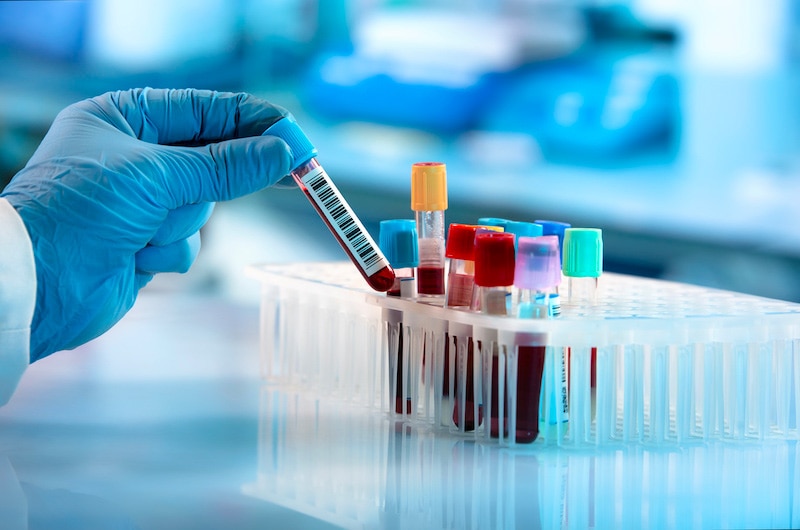 Novalturel - Intolérance au gluten - Protocole reequilibre intestinal