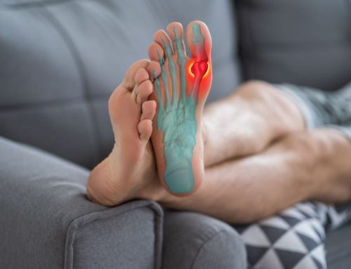 Comment éliminer les cristaux dans les articulations ?