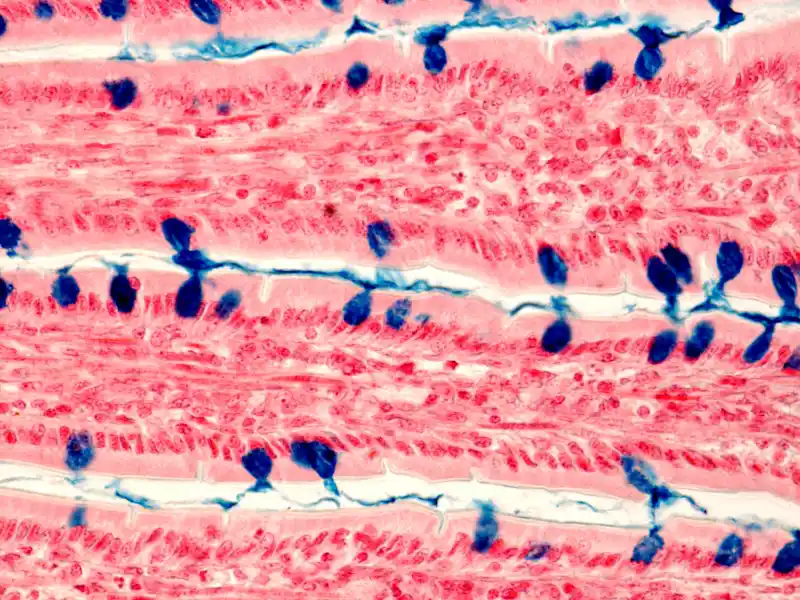 mal de ventre après effort physique - micro-perforations-tube-digestif - novalturel