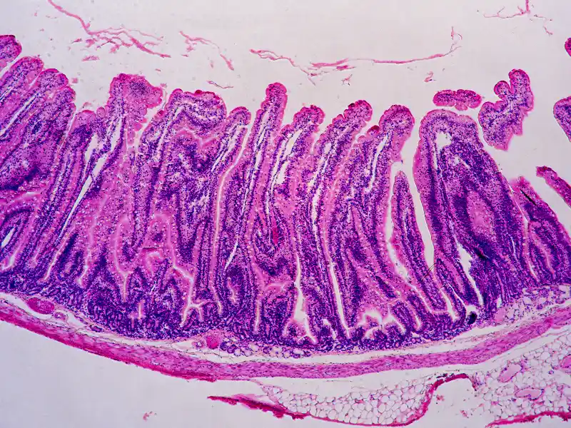 mal de ventre après effort physique - microlesion-petechies - novalturel