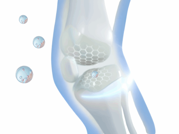 Quel est le meilleur collagène pour l’arthrose ?