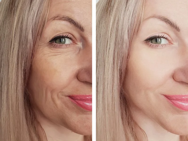 pourquoi-prendre-collagène-beauté-novalturel