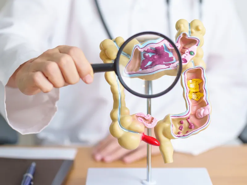 quoi manger colon irritable - cure rééquilibre intestinal - novalturel