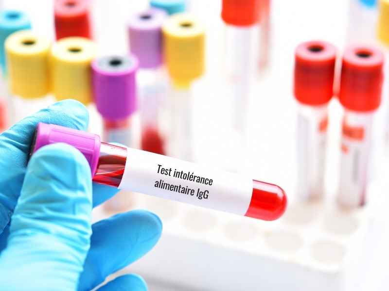 Test intolérance alimentaire IgG : comprendre les résultats