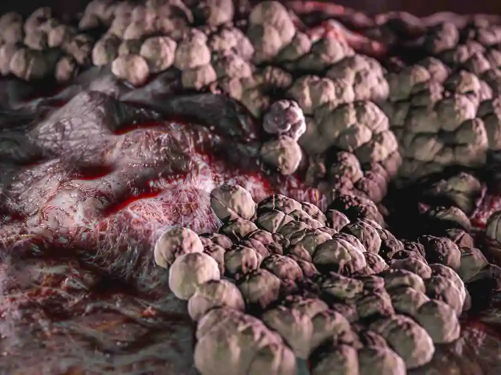 troubles intestinaux colon irritable perméabilité intestinale SII candidose candida albicans novalturel
