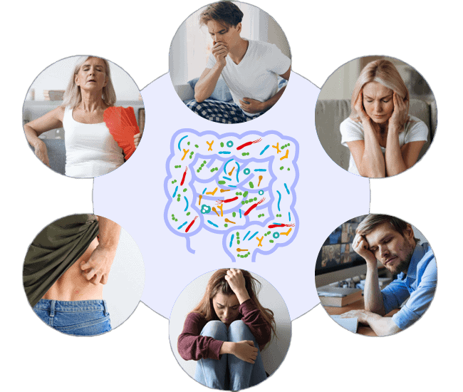 troubles intestinaux digestifs perméabilité intestinale syndrome intestin irritable